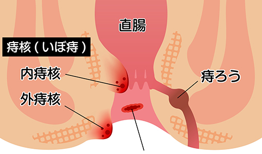 肛門内科